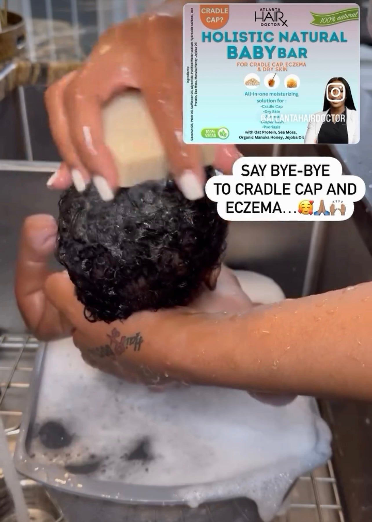HOLISTIC NATURAL BABY BAR (Cradle Cap Treatment for Babies, Soothes Babies Scalp, Prevents Dryness and Flakes) "Will Ship Sept. 2nd"
