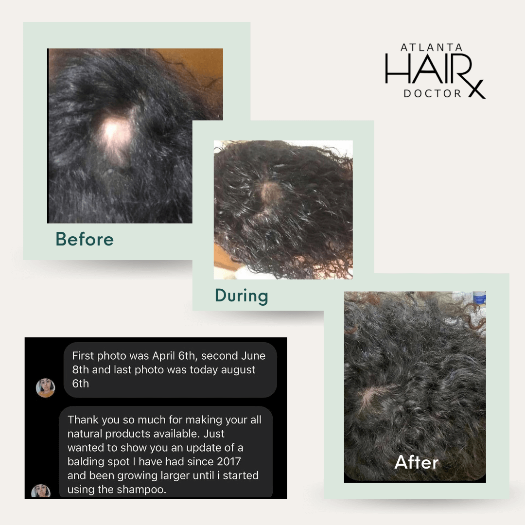 COMPLETE HAIR RESTORATION & GROWTH SYSTEM